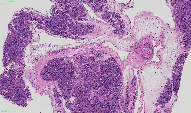 石蜡切片及染色