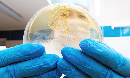 细菌培养的实际意义及应用领域