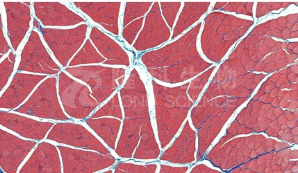 HE染色实操注意事项